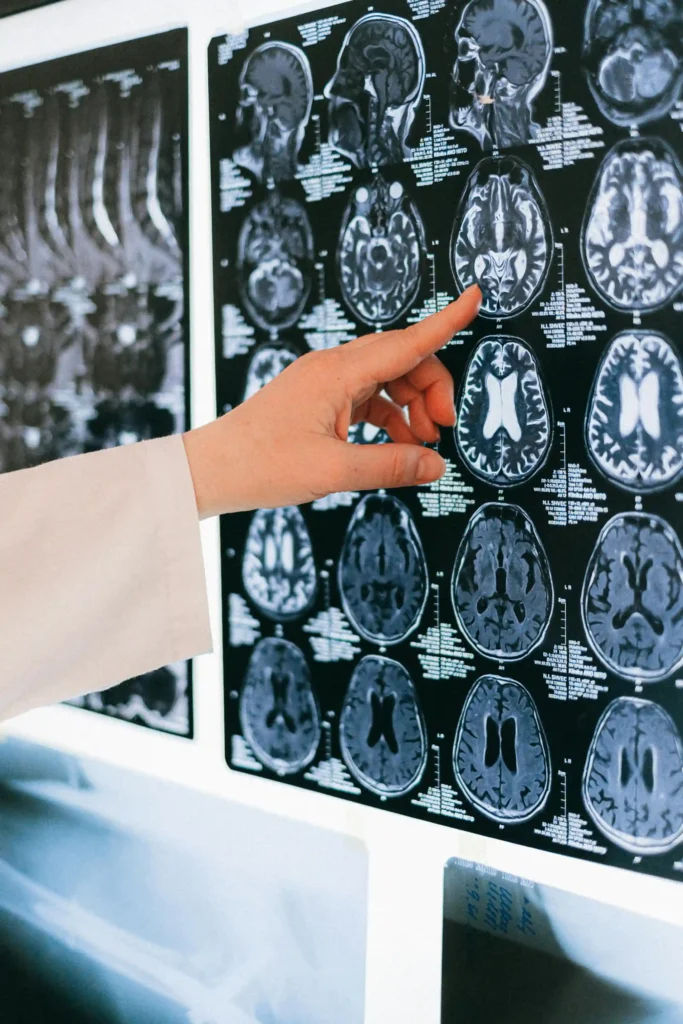 A doctor points to a series of brain scans placed on a light board. There are many small images of the brain, each slightly different. Indicating the complexity of analysing the images. 