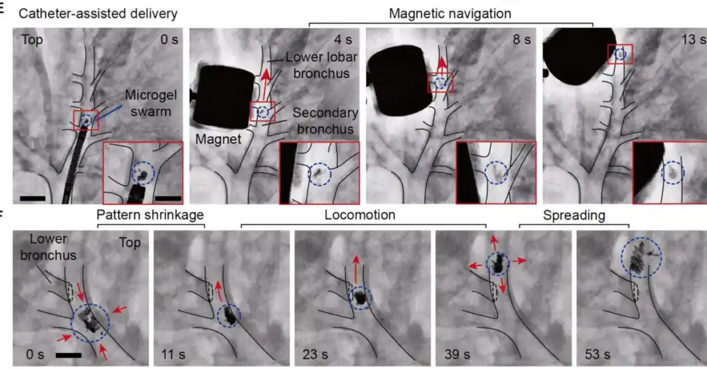 A panel of smaller images taken from the academic paper. IN the top row is four medical magnified images of a lung bronchus. The microgel swarm can be seen as small dots clustered in one of the tubes. A large black magnet is seem above the dots. As the images progres the magent and the swarm move upwards along the bronchus. In the bottom row is another four images. howing the swarm changing shaoe, getting smaller and getting larger. All images show how the swarm can move and change formation.