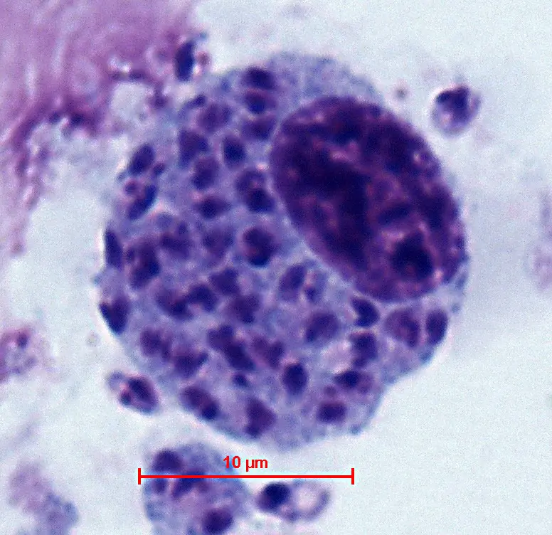  A micropscopic image  of a large round macrophage stained light purple. It is jam packed with parasites, shown in dark purple. 
