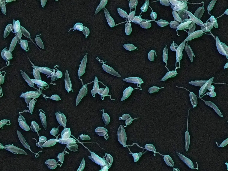 A microscopic image of Leishmania mexicana parasites in the promastigote stage. We can see dozens of them. Their pale blue bodies are visible against a black background.
