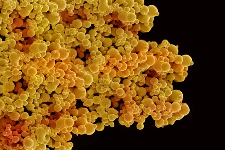 A cluster of small orange ball like structures against a black background. It is a microscope image of liposomes.